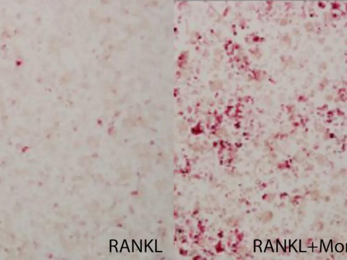 cells isolated from breast cancer cells